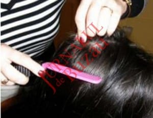 Păduchii și râia, încă prezente la școlari