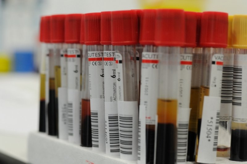 SML Buzău:Deficit major de medici legiști și laborator de toxicologie folosit doar pentru determinarea alcoolemiei pentru că nu există mijloace de detectare a drogurilor