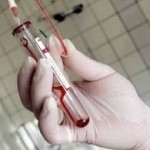 În judeţul nostru 110 persoane au HIV