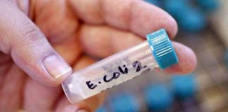 Probele prelevate pentru identificarea E-Coli verotoxigenă au fost negative, la Buzău