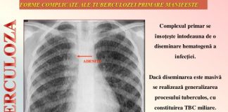 20 de elevi din Topliceni, depistaţi pozitiv la testarea tuberculinică