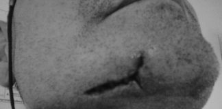 Politist local, desfigurat de un cetatean de etnie roma