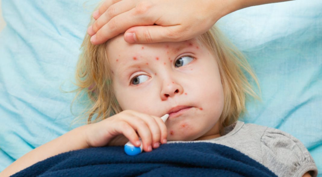 Vaccin-ROR-epidemie-rujeola-1170x644