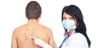 Continuă să crească numărul bolnavilor de rujeolă, în Buzău