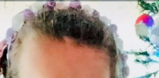 Apel umanitar pentru Bianca! Familia are nevoie de bani pentru operație