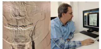 (FOTO) Premieră la Spitalul Județean. Intervenții în laboratorul de angiografie. ,,Ambii pacienți au avut o evoluție foarte bună”
